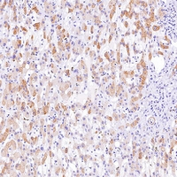 MSH6 Rabbit Monoclonal Antibody