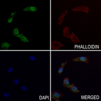 MSH6 Rabbit Monoclonal Antibody