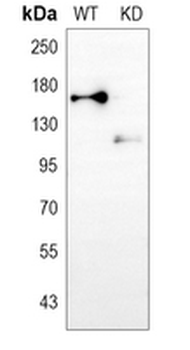MSH6 Rabbit Monoclonal Antibody