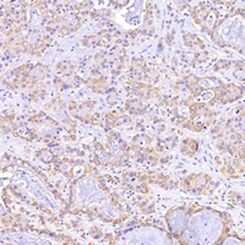 Cytokeratin 7 Rabbit Monoclonal Antibody