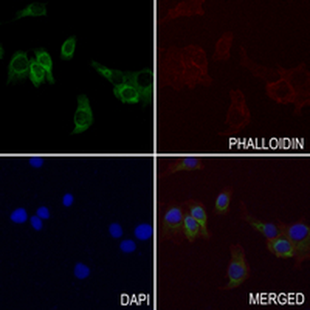 Cytokeratin 7 Rabbit Monoclonal Antibody