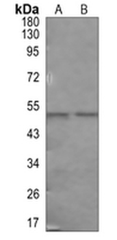 CD23 Rabbit Monoclonal Antibody