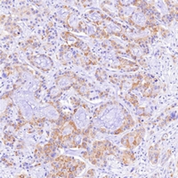 CD23 Rabbit Monoclonal Antibody