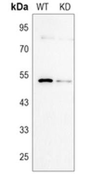 CD23 Rabbit Monoclonal Antibody