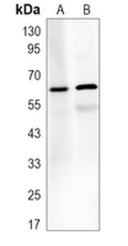 TAU (Phospho-T534/T217) Rabbit Monoclonal Antibody
