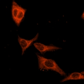 Goat Anti-Rabbit IgG (H&L) Antibody (AcalephFluor555)