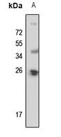 POLR2E Rabbit Polyclonal Antibody