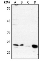 DARPP32 (Phospho-T75) Rabbit Polyclonal Antibody