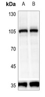 PRKD2 (Phospho-S876) Rabbit Polyclonal Antibody