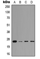 Prolactin Rabbit Polyclonal Antibody