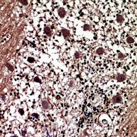 Prolactin Rabbit Polyclonal Antibody