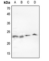p23 Rabbit Polyclonal Antibody