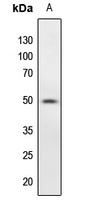 PTP1B (Phospho-S50) Rabbit Polyclonal Antibody