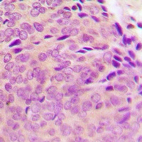 PTP1B (Phospho-S50) Rabbit Polyclonal Antibody