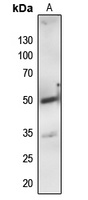 PTP1B Rabbit Polyclonal Antibody