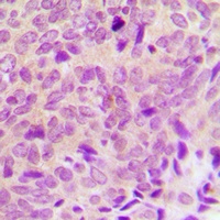 PTP1B Rabbit Polyclonal Antibody
