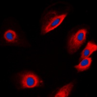PTP1B Rabbit Polyclonal Antibody