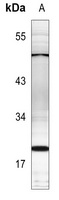 PTTG1IP Rabbit Polyclonal Antibody
