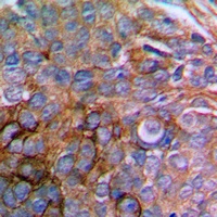 Paxillin Rabbit Polyclonal Antibody
