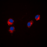 Paxillin Rabbit Polyclonal Antibody