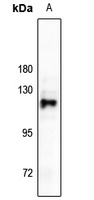 RB1 Rabbit Polyclonal Antibody