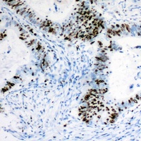 RB1 Rabbit Polyclonal Antibody