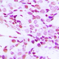 hnRNP G Rabbit Polyclonal Antibody