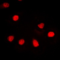 hnRNP G Rabbit Polyclonal Antibody