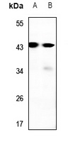 RAD52B Rabbit Polyclonal Antibody