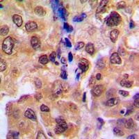 RAD52B Rabbit Polyclonal Antibody