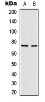 NF-kappaB p65 (Phospho-T435) Antibody