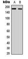 RET Rabbit Polyclonal Antibody