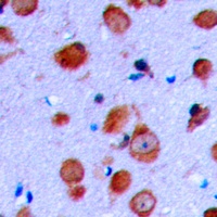 RET Rabbit Polyclonal Antibody
