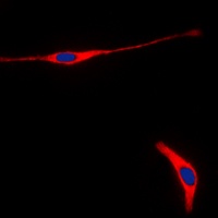 RET Rabbit Polyclonal Antibody