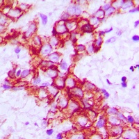 RET Rabbit Polyclonal Antibody