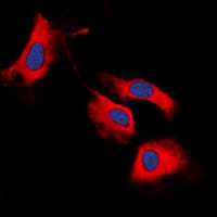 RET Rabbit Polyclonal Antibody