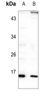 RPL22 Rabbit Polyclonal Antibody