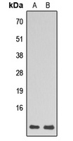 RPL39 Rabbit Polyclonal Antibody