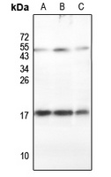 RPLP2 Rabbit Polyclonal Antibody