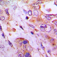 RPLP2 Rabbit Polyclonal Antibody