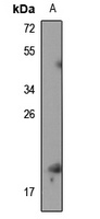 RPS19BP1 Antibody