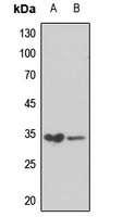 RPS6 (Phospho-S240) Rabbit Polyclonal Antibody