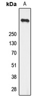Ryanodine Receptor 2 (Phospho-S2808) Antibody
