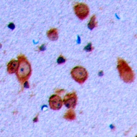 Ryanodine Receptor 2 (Phospho-S2808) Antibody