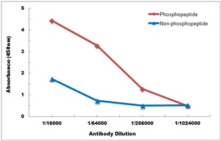 Ryanodine Receptor 2 (Phospho-S2808) Antibody