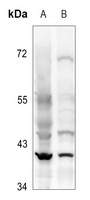 CD62L Rabbit Polyclonal Antibody