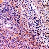 Serpin B3/4 Antibody