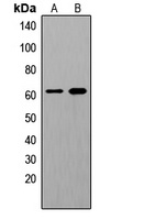 SHCA (Phospho-Y349) Rabbit Polyclonal Antibody
