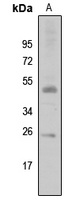 SIAH2 Rabbit Polyclonal Antibody