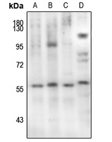 SMAD2 (Phospho-S467) Rabbit Polyclonal Antibody